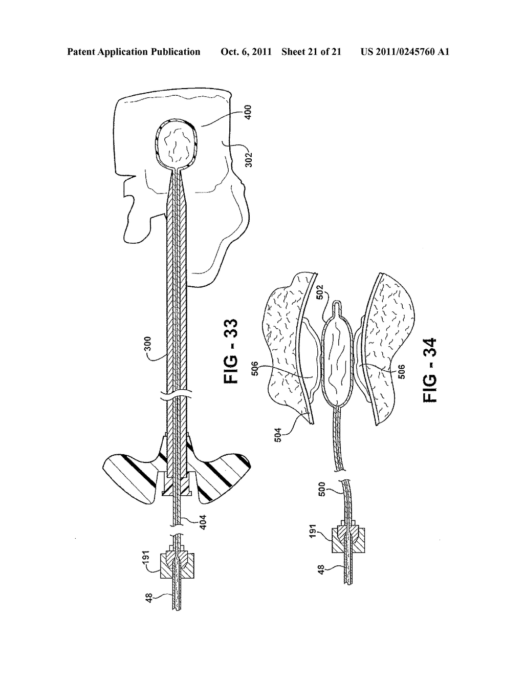 SYSTEM FOR USE DURING DISCOGRAPHY TO WIRELESSLY TRANSMIT DATA FROM     HAND-HELD FLUID DELIVERY DEVICE INSIDE STERILE FIELD TO DEVICE OUTSIDE     STERILE FIELD - diagram, schematic, and image 22