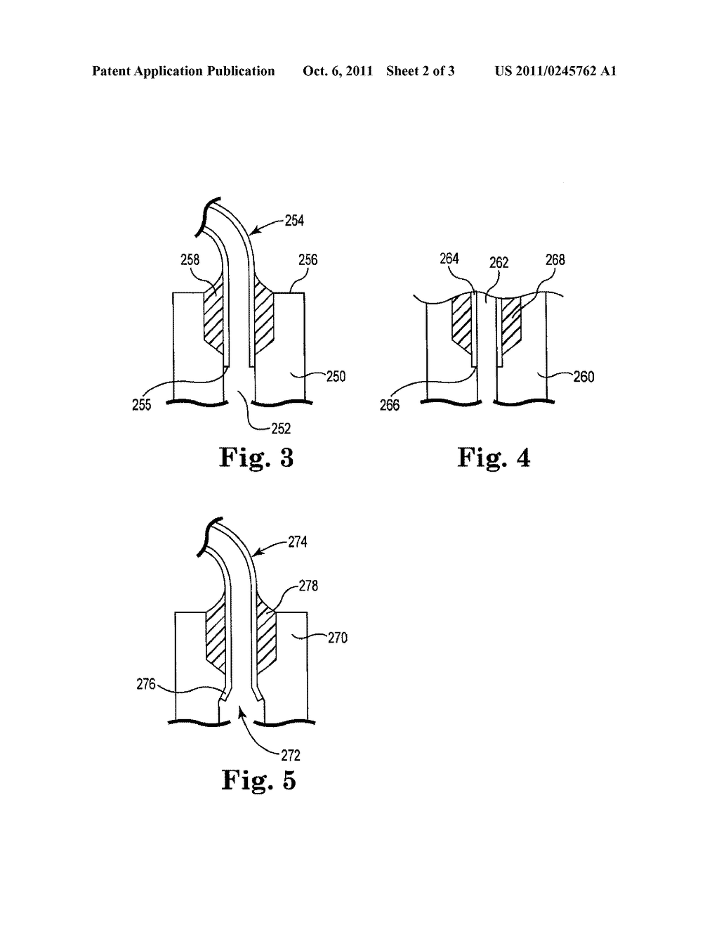 DEVICES, SYSTEMS AND METHODS FOR DELIVERING FLUID TO TISSUE - diagram, schematic, and image 03