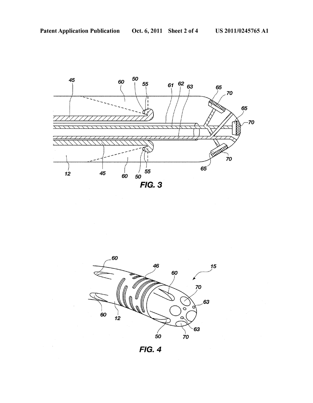 Method And Apparatus For Manipulating Movement of a Micro-Catheter - diagram, schematic, and image 03