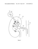 Method and Apparatus for Improving Delivery of an Agent to a Kidney diagram and image