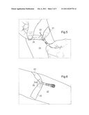 DRESSING FOR FIXING AND PROTECTING A NEEDLE diagram and image