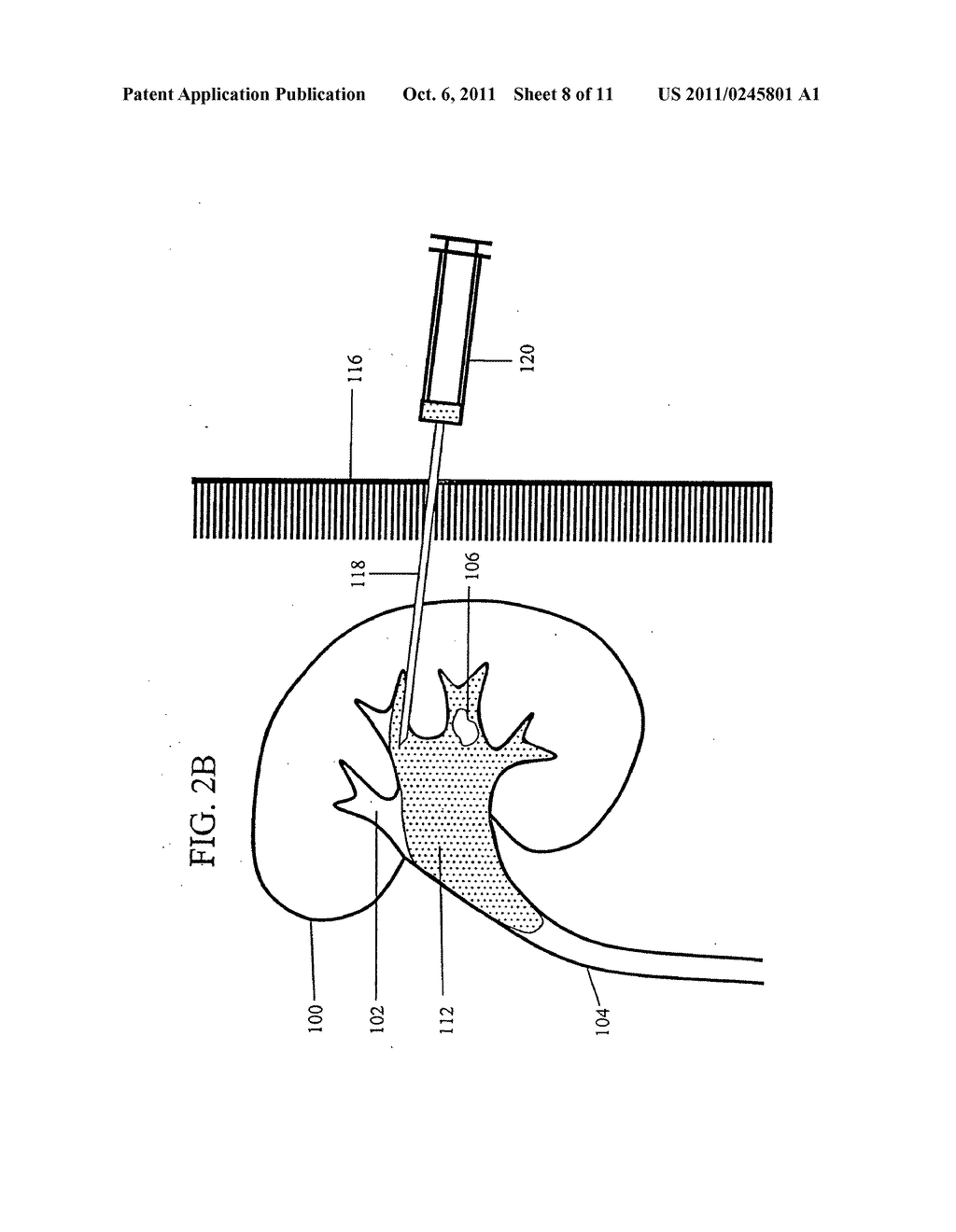 IMMOBILIZING OBJECTS IN THE BODY - diagram, schematic, and image 09