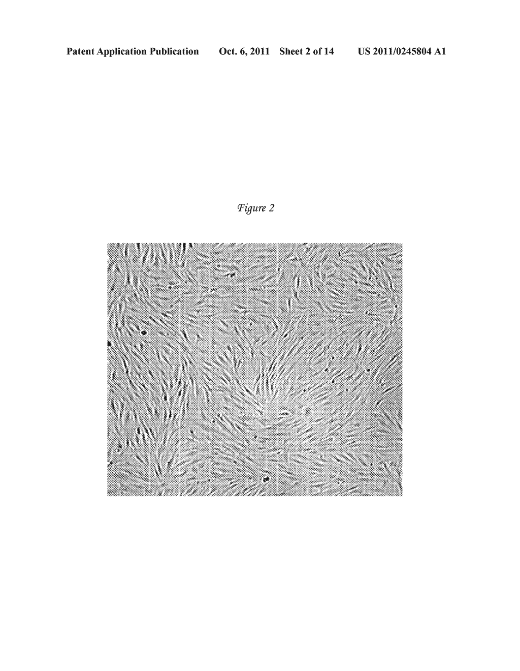 Methods and Compositions to Facilitate Repair of Avascular Tissue - diagram, schematic, and image 03