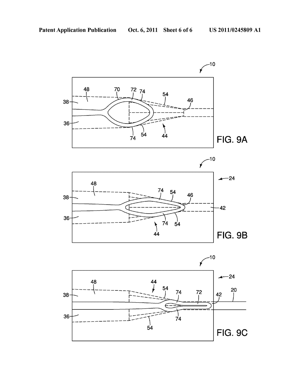 Hub For Loop Tip Devices - diagram, schematic, and image 07