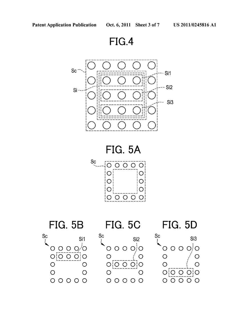 OPHTHALMIC LASER TREATMENT APPARATUS - diagram, schematic, and image 04