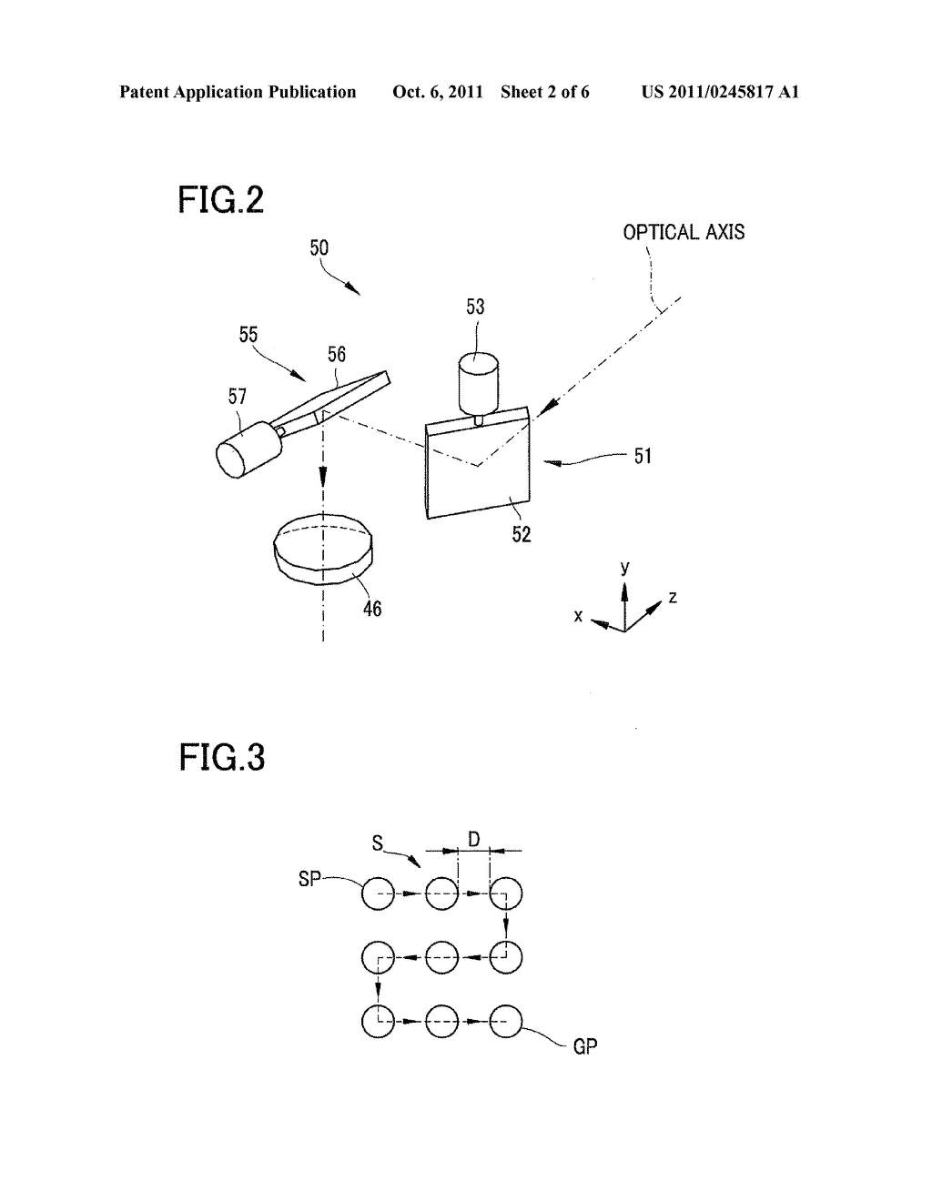 OPHTHALMIC LASER TREATMENT APPARATUS - diagram, schematic, and image 03