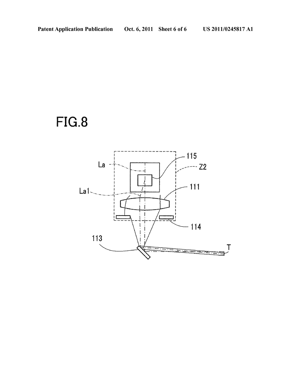 OPHTHALMIC LASER TREATMENT APPARATUS - diagram, schematic, and image 07