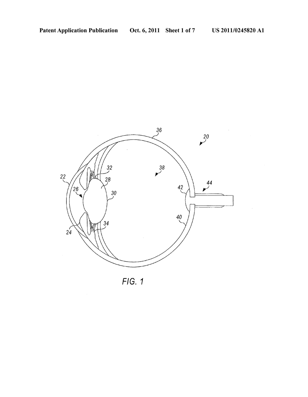 APPARATUS FOR ENHANCING BRIGHTNESS OF A WAVELENGTH CONVERTING ELEMENT - diagram, schematic, and image 02