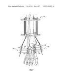 FOOT, ANKLE AND LOWER EXTREMITY COMPRESSION AND FIXATION SYSTEM AND     RELATED USES diagram and image