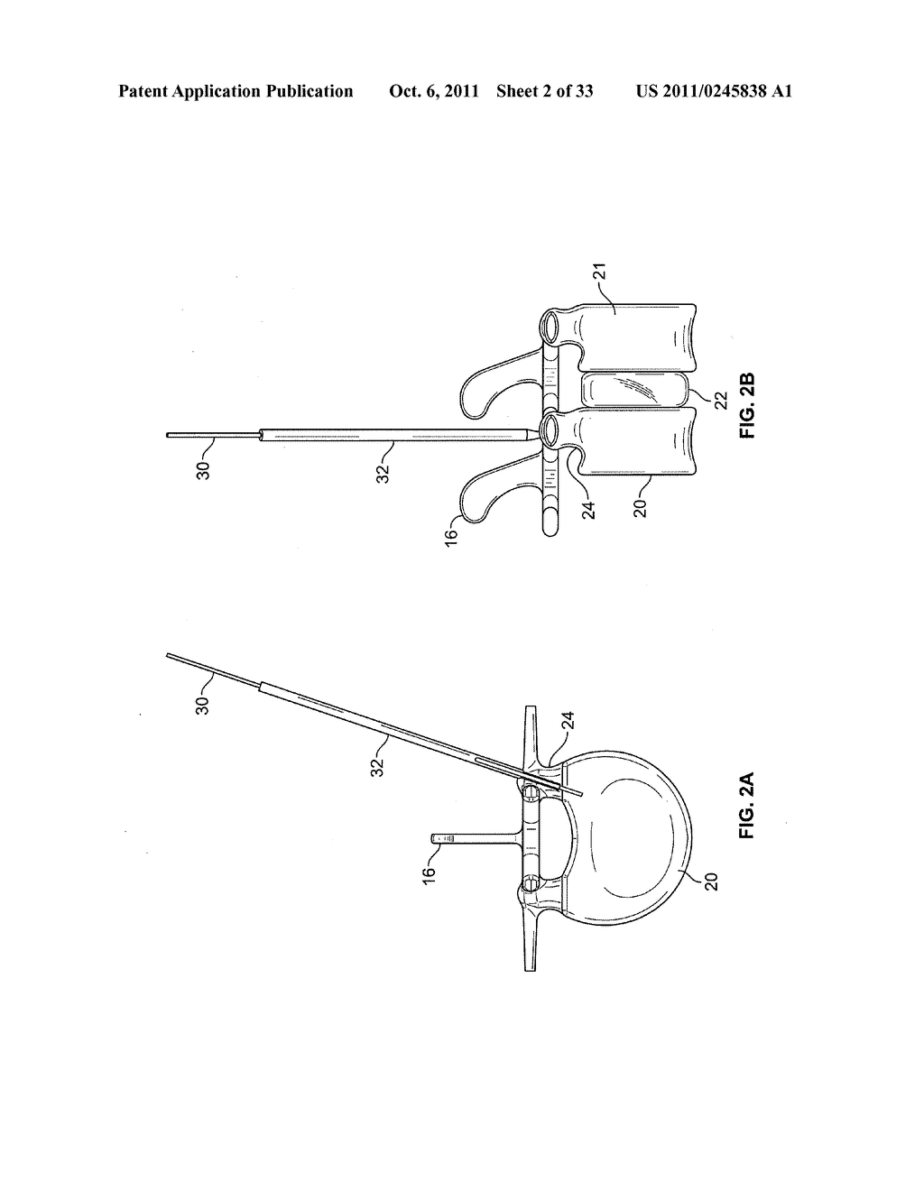 PERCUTANEOUS TRANSPEDICULAR ACCESS, FUSION, DISCECTOMY, AND STABILIZATION     SYSTEM AND METHOD - diagram, schematic, and image 03