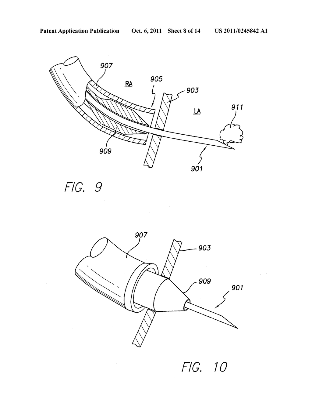 LEFT CHAMBER PRESSURE SENSOR LEAD DELIVERY SYSTEM - diagram, schematic, and image 09