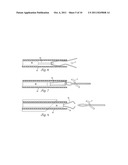 NON-INVASIVE SURGICAL LIGATION CLIP SYSTEM AND METHOD OF USING diagram and image