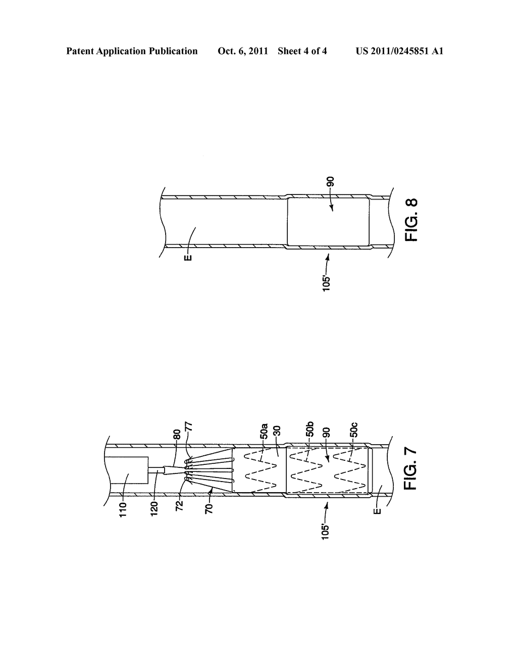 REMOVABLE MEDICAL DEVICE HAVING AT LEAST ONE PATCH MEMBER - diagram, schematic, and image 05