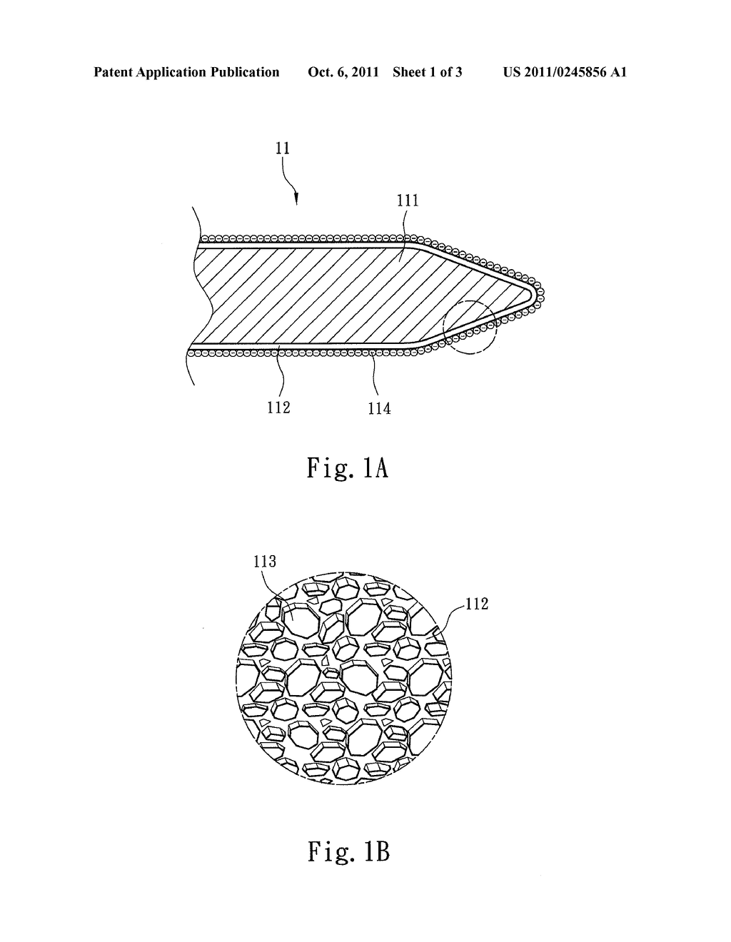 POROUS ACUPUNCTURE NEEDLE - diagram, schematic, and image 02