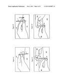 ACUPUNCTURE NEEDLE DELIVERY SYSTEM diagram and image