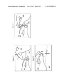 ACUPUNCTURE NEEDLE DELIVERY SYSTEM diagram and image