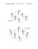 Rod and plate system for incremental reduction of the spine diagram and image