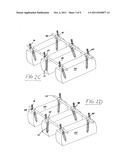 Rod and plate system for incremental reduction of the spine diagram and image