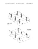 Rod and plate system for incremental reduction of the spine diagram and image