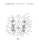 RETENTION MECHANISMS FOR ROD LOCKING SET SCREWS diagram and image