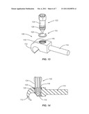 RETENTION MECHANISMS FOR ROD LOCKING SET SCREWS diagram and image