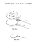 FLEXIBLE RECHARGE COIL TECHNIQUES diagram and image