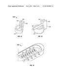 METHOD OF FABRICATING IMPLANTABLE PULSE GENERATOR USING WIRE CONNECTIONS     TO FEEDTHROUGH STRUCTURES AND IMPLANTABLE PULSE GENERATORS diagram and image