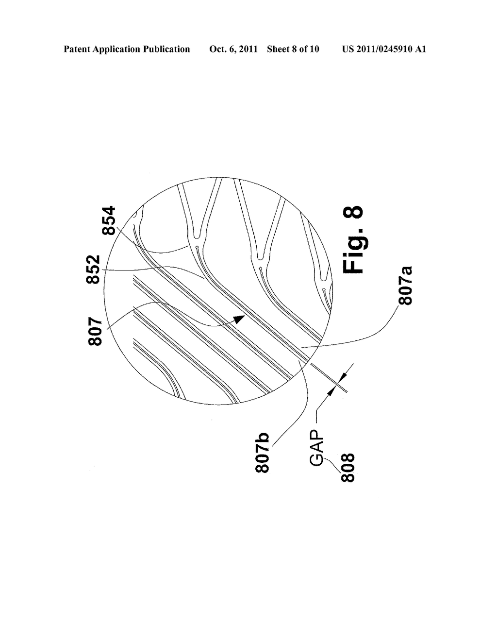 FLEXIBLE STENT - diagram, schematic, and image 09