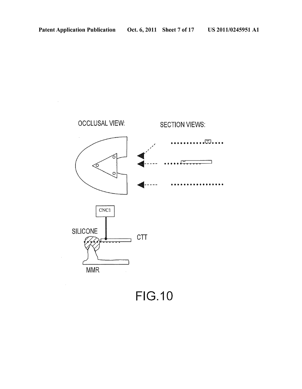 ASSISTED DENTAL IMPLANT TREATMENT AND REPLICATION SYSTEM - diagram, schematic, and image 08