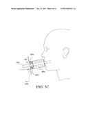 APPARATUS AND METHOD FOR DELIVERY OF AN AEROSOL diagram and image