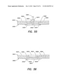 METHODS AND APPARATUS FOR MEASURING ANALYTES USING LARGE SCALE FET ARRAYS diagram and image