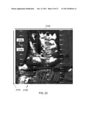 Combination Laser and Charged Particle Beam System diagram and image