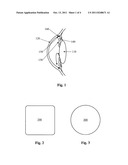 Power System Implantable in Eye diagram and image