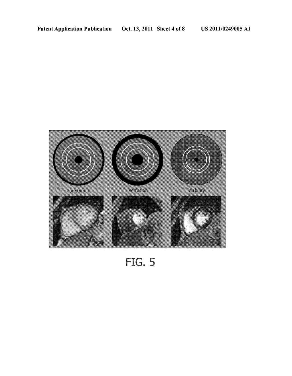 REPARAMETRIZED BULL'S EYE PLOTS - diagram, schematic, and image 05