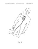 AUTOMATIC ROAD MAPPING FOR HEART VALVE REPLACEMENT diagram and image