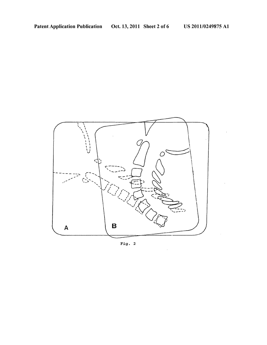 METHOD OF PERFORMING MEASUREMENTS ON DIGITAL IMAGES - diagram, schematic, and image 03