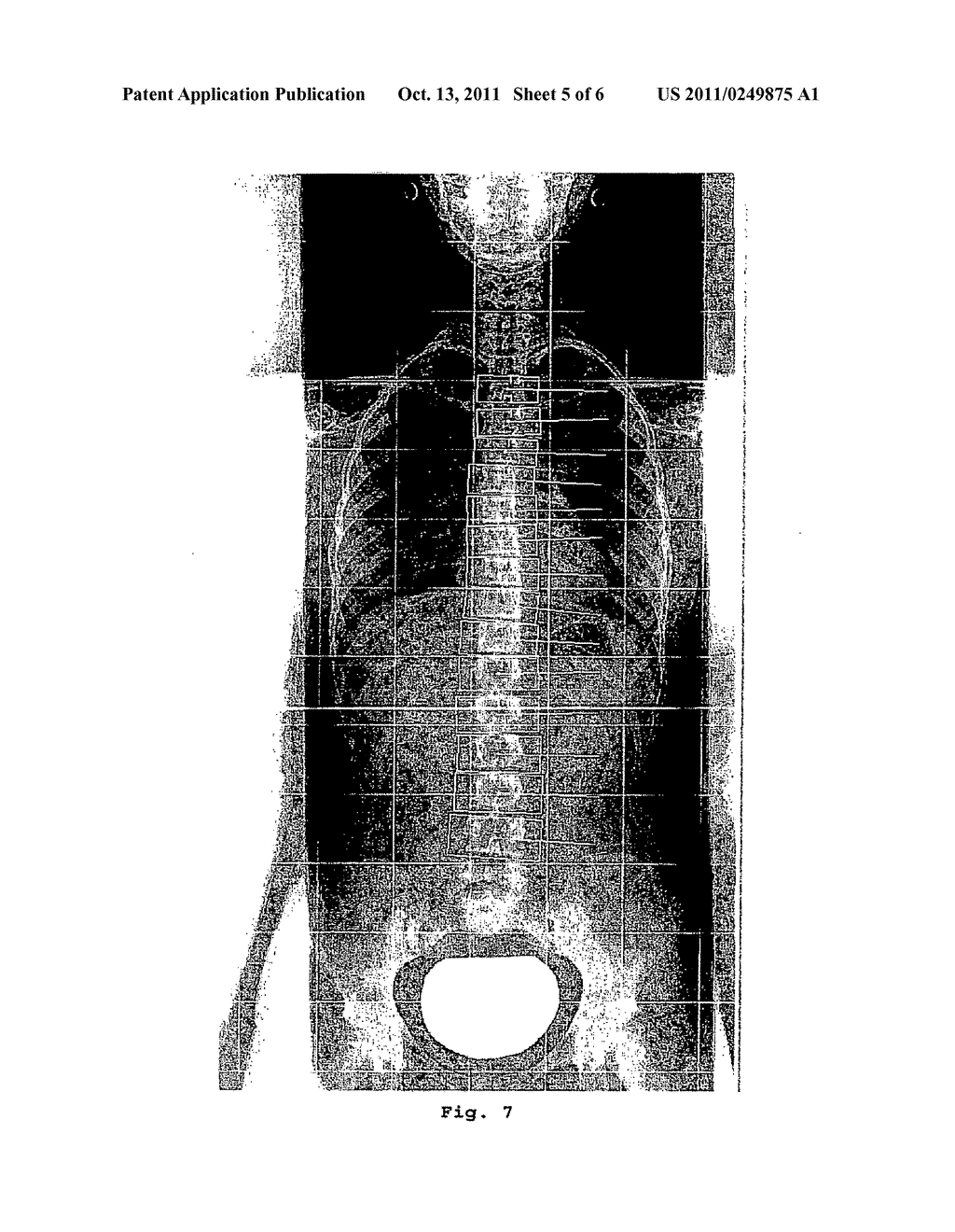 METHOD OF PERFORMING MEASUREMENTS ON DIGITAL IMAGES - diagram, schematic, and image 06