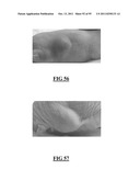 GASTRIN RELEASING PEPTIDE COMPOUNDS diagram and image