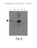 HUMAN LYSOSOMAL PROTEINS FROM PLANT CELL CULTURE diagram and image