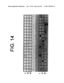 ANTAGONISTS OF IL-6 TO RAISE ALBUMIN AND/OR LOWER CRP diagram and image