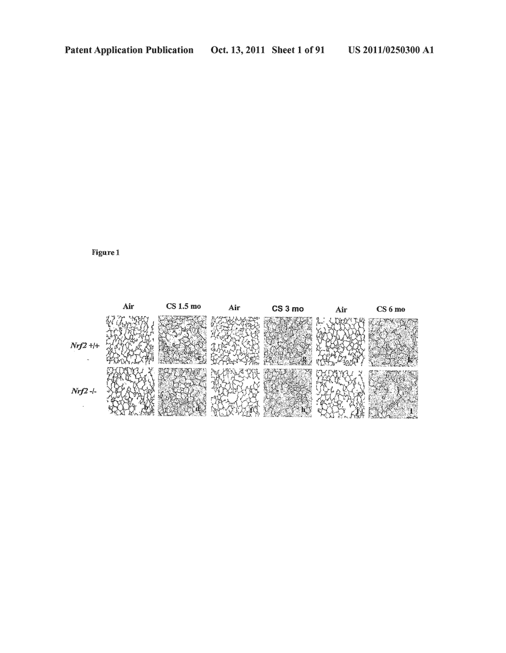 COMPOSITIONS AND METHODS FOR THE TREATMENT OR PREVENTION OF DISORDERS     RELATING TO OXIDATIVE STRESS - diagram, schematic, and image 02
