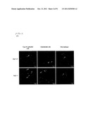 COMPOSITIONS AND METHODS FOR THE TREATMENT OR PREVENTION OF DISORDERS     RELATING TO OXIDATIVE STRESS diagram and image