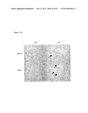 COMPOSITIONS AND METHODS FOR THE TREATMENT OR PREVENTION OF DISORDERS     RELATING TO OXIDATIVE STRESS diagram and image