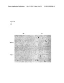 COMPOSITIONS AND METHODS FOR THE TREATMENT OR PREVENTION OF DISORDERS     RELATING TO OXIDATIVE STRESS diagram and image