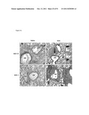 COMPOSITIONS AND METHODS FOR THE TREATMENT OR PREVENTION OF DISORDERS     RELATING TO OXIDATIVE STRESS diagram and image