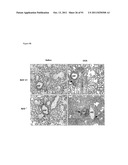 COMPOSITIONS AND METHODS FOR THE TREATMENT OR PREVENTION OF DISORDERS     RELATING TO OXIDATIVE STRESS diagram and image