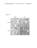 COMPOSITIONS AND METHODS FOR THE TREATMENT OR PREVENTION OF DISORDERS     RELATING TO OXIDATIVE STRESS diagram and image