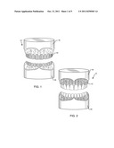 PREFABRICATED COMPOSITE LAYERS FOR DUPLICATION OF TOOTH STRUCTURE AND     MUCOSAL TISSUE diagram and image