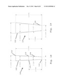 DENTIN ANCHOR diagram and image