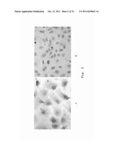 BIOMARKER AND METHOD FOR DETECTING A CHRONIC INFLAMMATORY-ASSOCIATED     DISEASE diagram and image